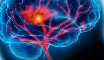 Cibler le fonctionnement des vaisseaux lymphatiques des méninges pour lutter contre les maladies neurologiques ?