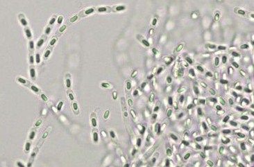 Infections nosocomiales : la bactérie Bacillus cereus peut aussi en être la cause